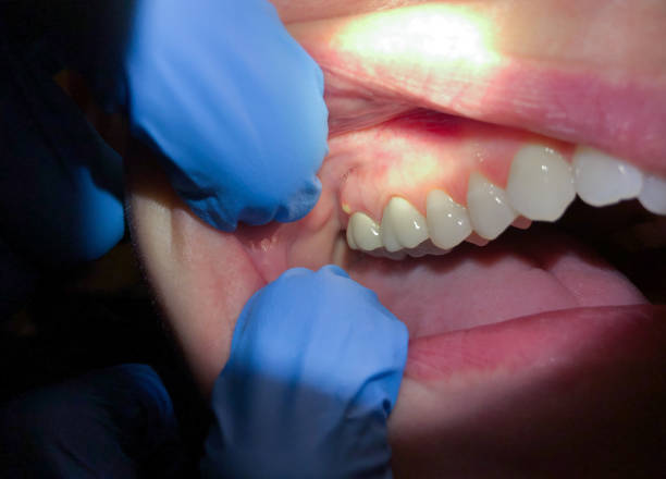 Best Emergency Pediatric Dental Care in South Boston, VA